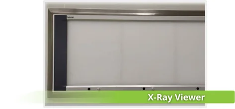 X-Ray Viewer